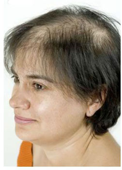 innovacion capilar
